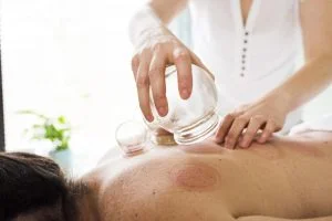 Cupping